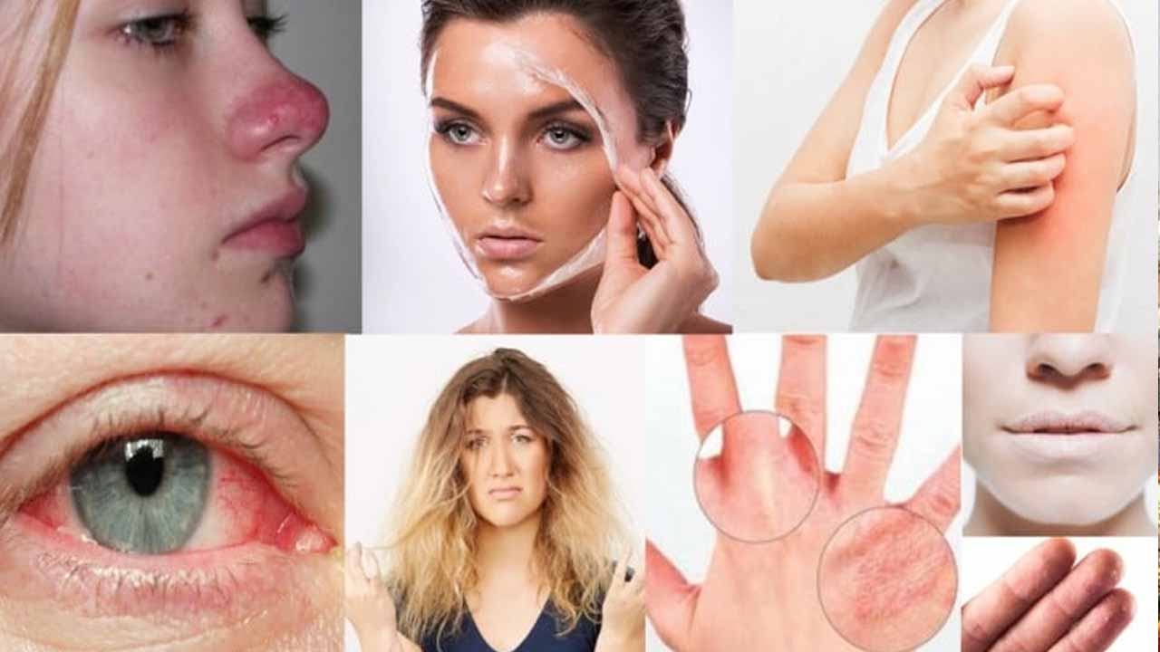 Winter Tips : శీతాకాలం ఈ చిట్కాలు ఎంతో మేలు చేస్తాయి..