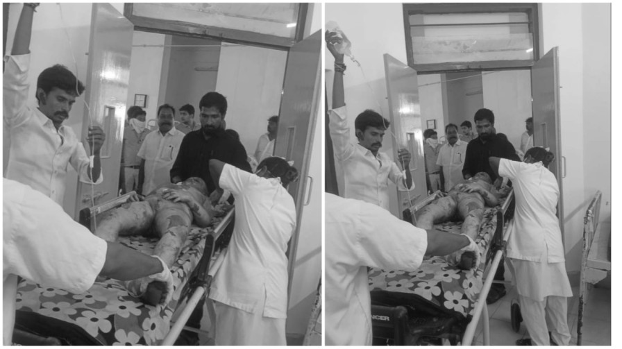 Diwali Fire: దీపావళి వేళ విషాదం.. మందులు కాలుస్తూ బాలుడి మృతి