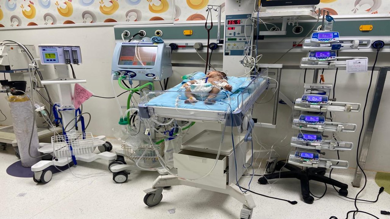 Rainbow Children Hospitals: దేశంలోనే మొట్టమొదటిసారి.. నవజాత శిశువుల కోసం అంబులెన్స్‌లో అత్యాధునిక వెంటిలేషన్‌