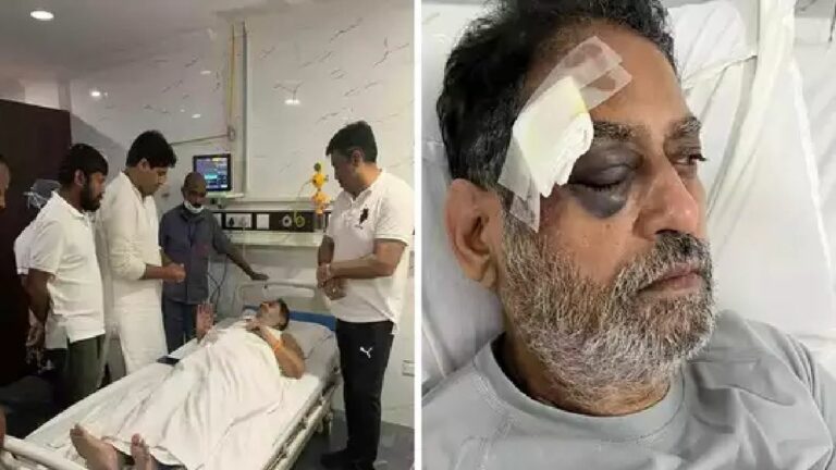 Bharat Jodo Yatra: రాహుల్ పాదయాత్రలో అపశృతి.. మాజీ మంత్రికి తీవ్రగాయాలు