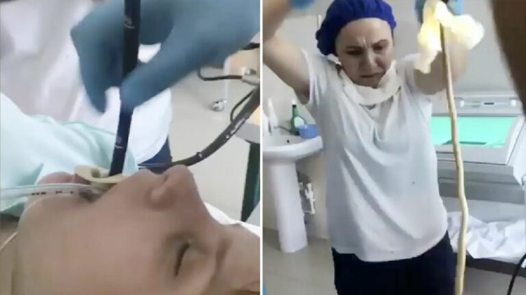 Snake in Woman Mouth: మహిళ నోట్లో దూరిన పాము.. వామ్మో.. తీసిన డాక్టరే షాక్