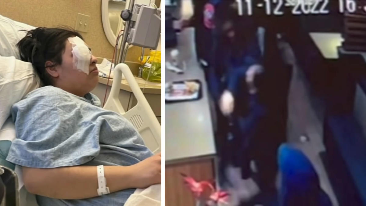 Viral Video: మంచికి రోజుల్లేవంటే ఇదేనేమో.. చివరికి కన్ను పోయిందిగా..