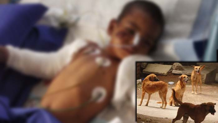 Dog Attack Child: బాలిక పై వీధి కుక్కుల దాడి.. పరిస్థితి విషమం