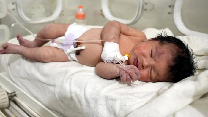 Turkey Earthquake: ఆ పాప ఓ అద్భుతం.. శిథిలాల కిందే జననం