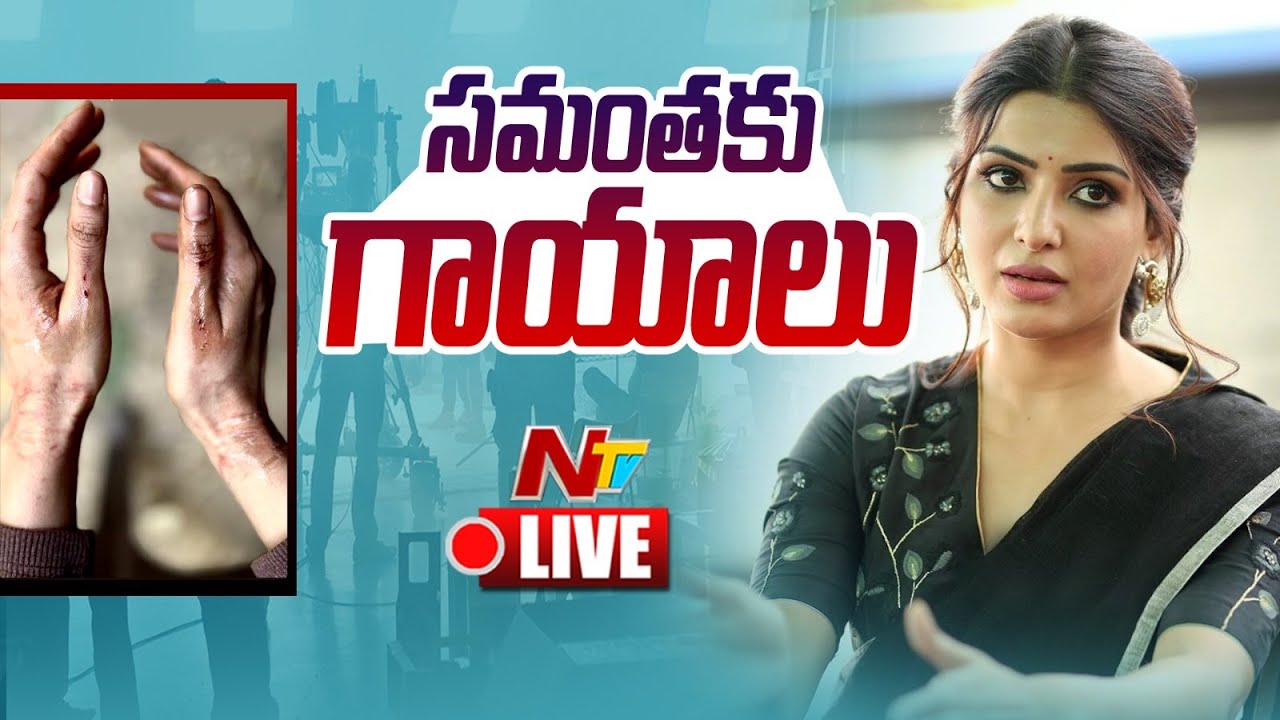 Samantha Ruth Prabhu Injured Live: వెబ్ సిరీస్ షూటింగ్.. సమంతకు గాయాలు