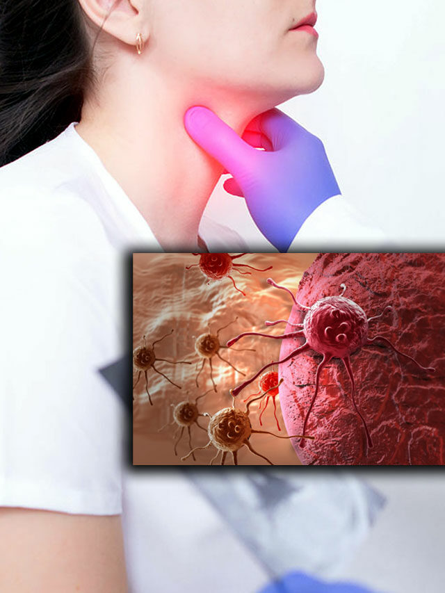 Cancer Prevent Foods: క్యాన్సర్‌ని నివారించే ఫుడ్ ఐటమ్స్.. తరచూ తీసుకుంటే ఎంతో మేలు