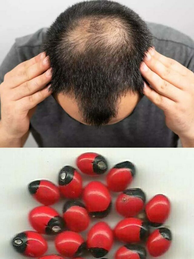 Baldness: పురుషులకు బట్టతల.. గురివిందాకు రసం నిజంగా వరమే