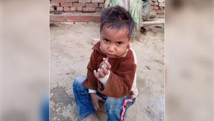 Toilet Collapse: కూలిన ప్రభుత్వ మరుగుదొడ్డి.. ఐదేళ్ల చిన్నారి సజీవ సమాధి