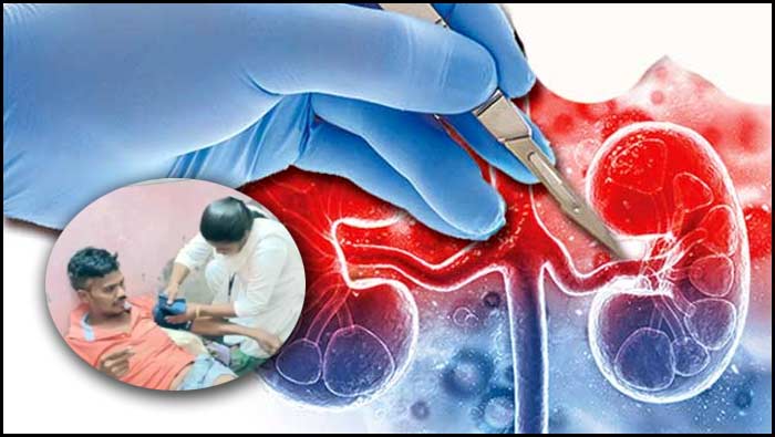 Kidney Racket: కిడ్నీ రాకెట్ కేసుని ఛేధించిన పోలీసులు.. వాళ్లే టార్గెట్