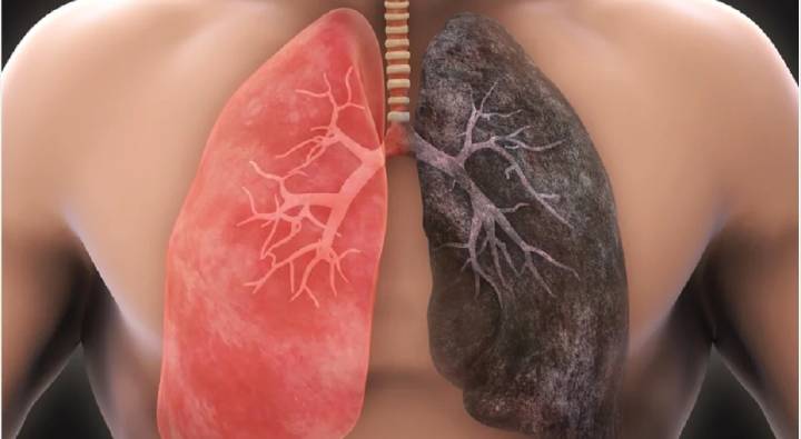 Lungs