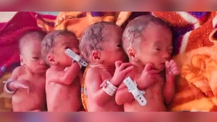 Qudruplets: ఒకే కాన్పులో నలుగురు పిల్లలకు జననం