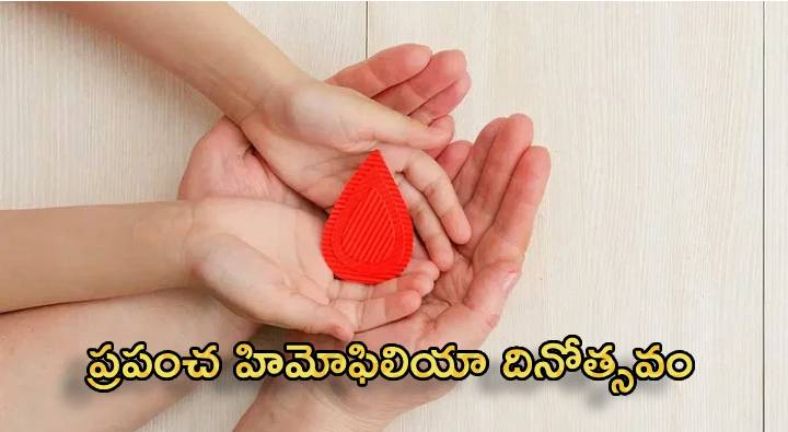 World Hemophilia Day : ప్రతేడాది మిలియన్ల మందిని పీడిస్తున్న హీమోఫిలియా