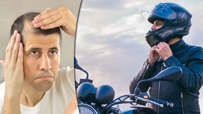 Helmet Hair Loss
