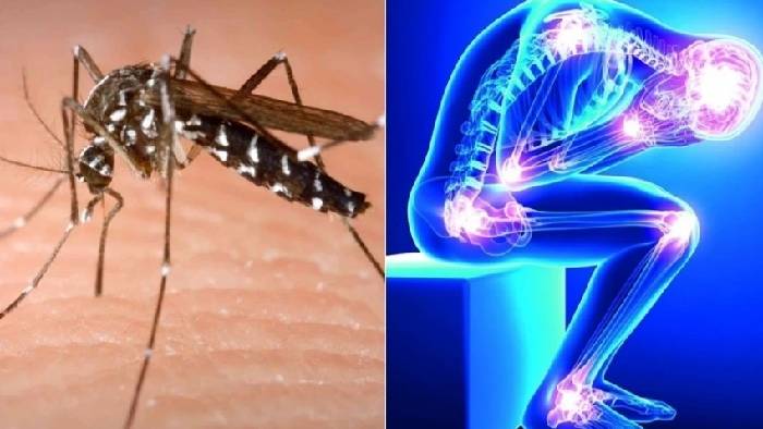 Chikungunya Vaccine: చికున్‌గున్యాకు వ్యాక్సిన్ రాబోతోంది.. ట్రయల్స్‌లో సానుకూల ఫలితాలు..