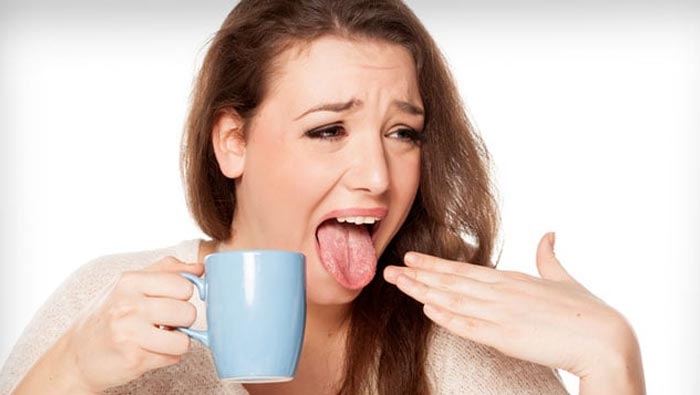 Hot Food:  నాలుక కాలిపోయిందా? ఈ చిట్కాలను ప్రయత్నించండి..!