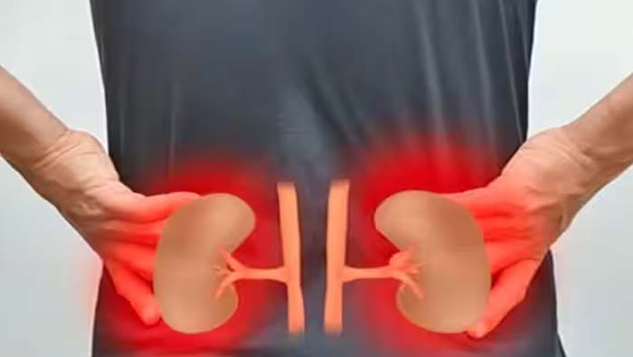 Kidney