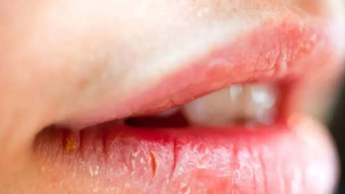 West Bengal: ప్రేమ విషయంలో గొడవ.. ప్రియుడి పెదాలు కోసిన ప్రియురాలి పేరెంట్స్