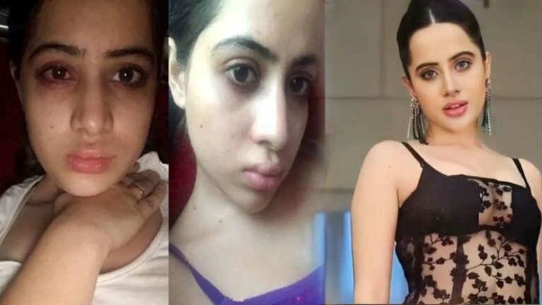 Urfi Javed:  సర్జరీ ఫెయిల్.. గుర్తుపట్టలేనంతగా మారిన బోల్డ్ బ్యూటీ..