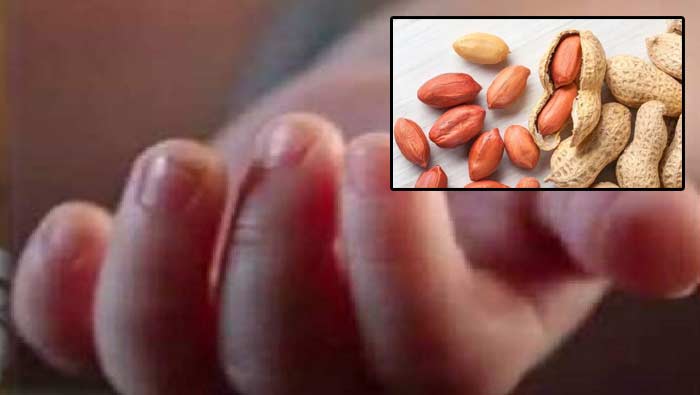 Peanut Stuck In Throat: గొంతులో ఇరుక్కున్న వేరుశనగ.. రెండేళ్ల చిన్నారి మృతి