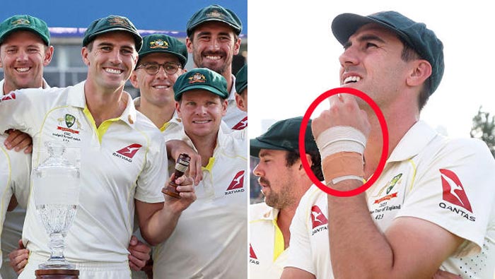 Pat Cummins: ఇండియాలో పర్యటనకు ముందు ఆసీస్⁬కు షాక్..!