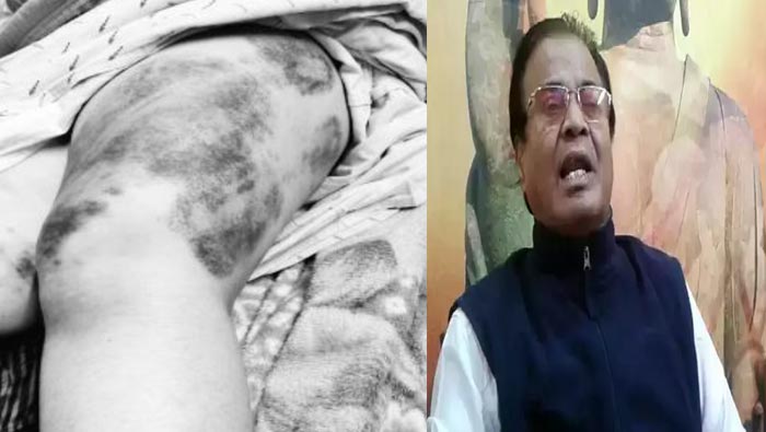 LBnagar PS⁬ Incident: ఢిల్లీకి చేరిన ఎల్బీనగర్ పీఎస్⁬లో మహిళపై దాడి ఘటన