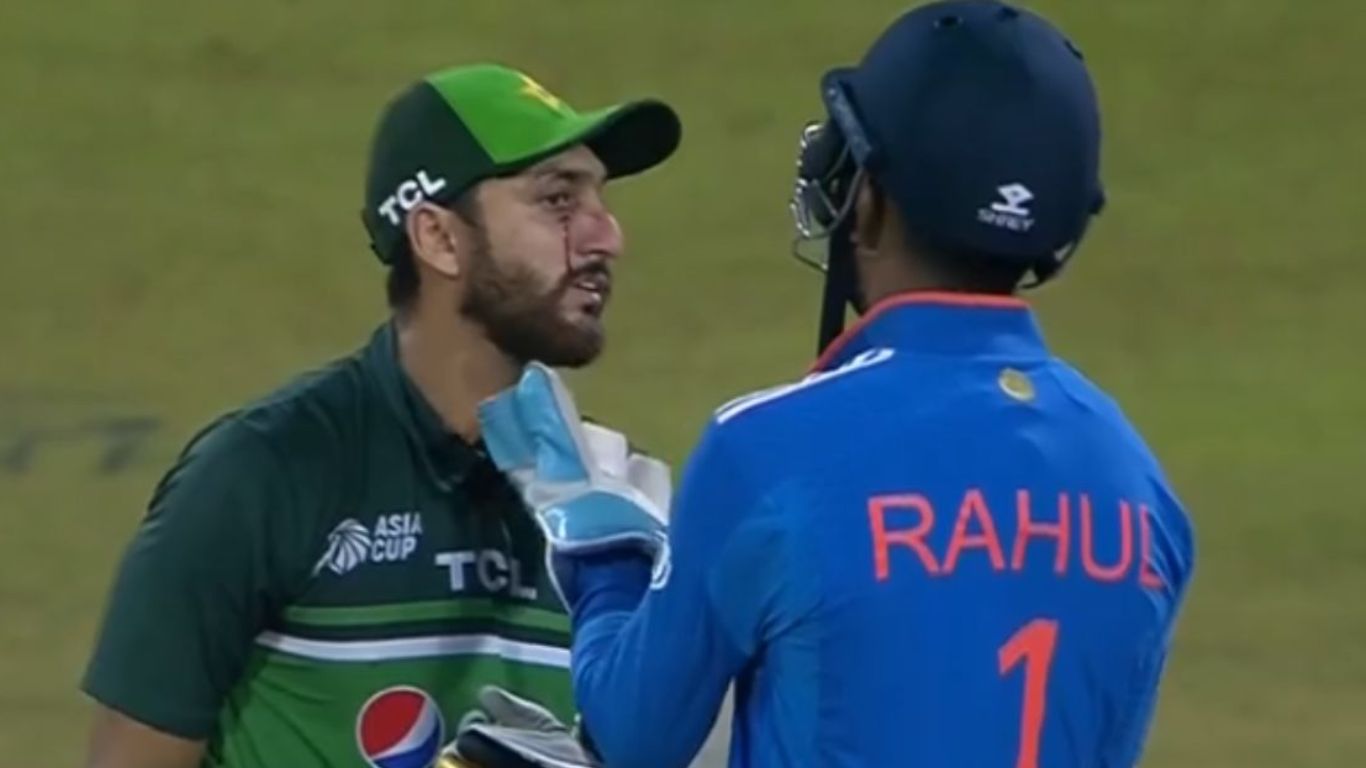 Asia Cup 2023: పాకిస్తాన్ క్రికెటర్‌కు తీవ్ర గాయం.. కారణం రవీంద్ర జడేజా! వీడియో వైరల్