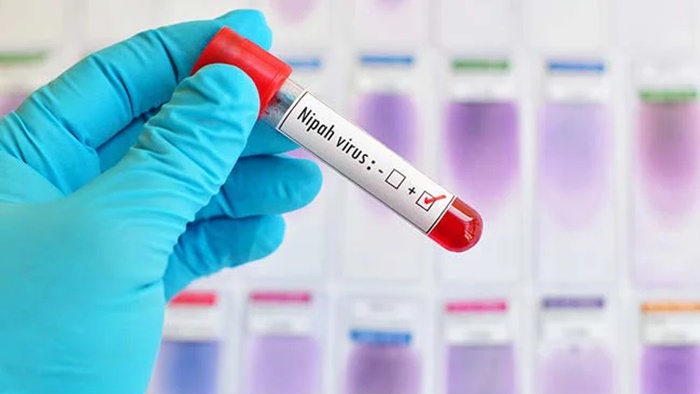 Nipah Virus