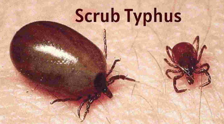 Scrub Typhus: మహారాష్ట్ర వైద్యశాఖ అప్రమత్తం… రాష్ట్రంలో ప్రవేశించిన స్క్రబ్ టైఫస్