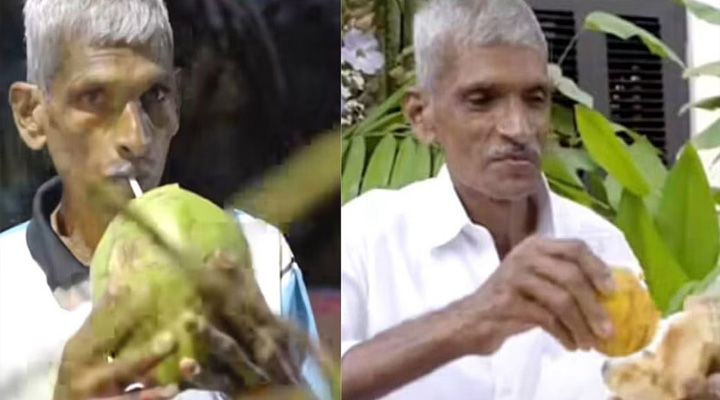 Coconut Diet: 28 ఏళ్లుగా ఒకటే ఆహారం తింటున్న వ్యక్తి.. కారణం అదే?