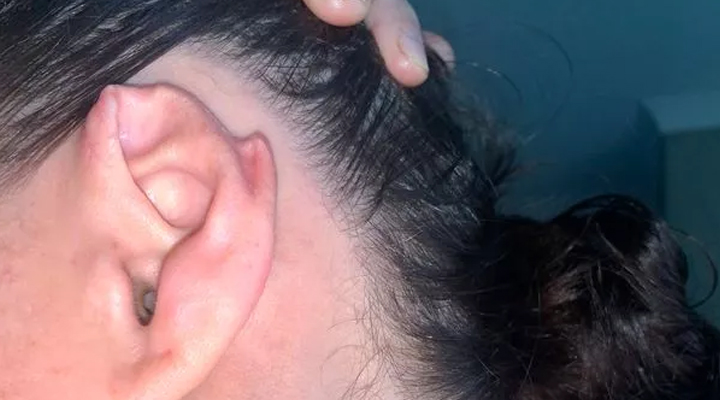 Ear Problems: చెవిలో నుంచి చీము కారుతూ నొప్పిగా ఉందా? ఈ చిట్కాలు పాటించండి?