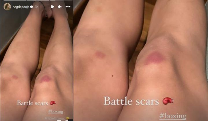 Pooja Hegde: అయ్యో.. పూజా.. చూసుకోవాలి కదరా.. చూడు ఎంతపెద్ద దెబ్బ తగిలిందో..?