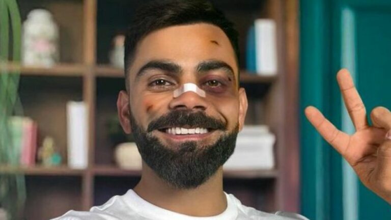 Virat Kohli Injury: ముఖం మొత్తం కమిలింది.. విరాట్ కోహ్లీకి ఏమైంది?