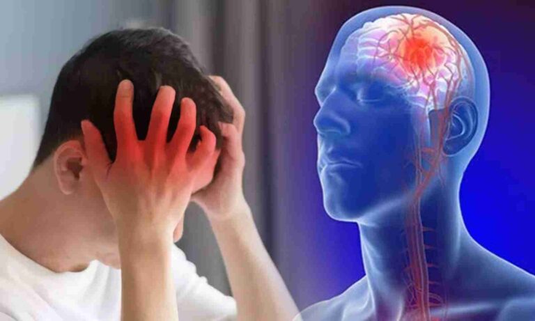 Brain Stroke: బ్రెయిన్ స్ట్రోక్ రాకుండా ఉండాలంటే ఏం చెయ్యాలో తెలుసా?