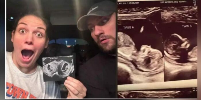 Uteruses Pregnant: మహిళకు రెండు గర్భాలు.. రెండు పిండాలు.. షాకవుతున్న వైద్యులు..