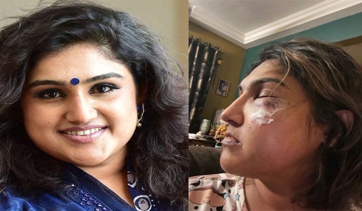 Vanitha Vijay Kumar: బిగ్ బాస్ కాంట్రవర్సీ… అర్ధరాత్రి నటిపై దాడి
