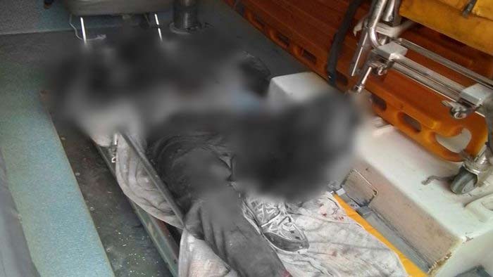 Hyderabad: పాతబస్తీలో కెమికల్ బ్లాస్ట్.. ఓ వృద్దుడికి తీవ్ర గాయాలు.