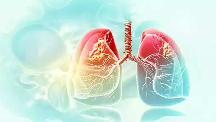 Cold Tips : ఛాతీలోని గట్టి కఫాన్ని కరిగించే సూపర్ హోం రెమెడీ..!