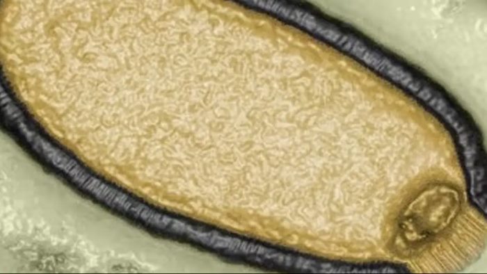 Zombie Virus
