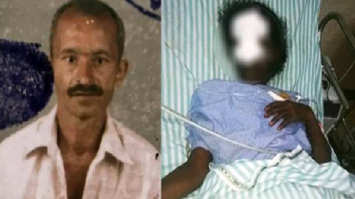 Man Chops Nose: గార్డెన్‌లో పూలు కోసినందుకు మహిళ ముక్కు కోసిన వ్యక్తి..