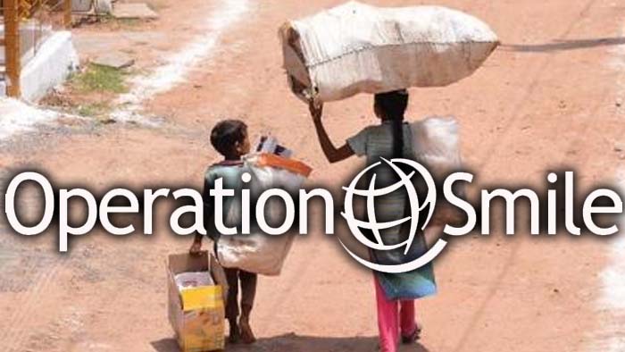 Operation Smile: నేటి నుంచి ఆపరేషన్‌ స్మైల్‌.. జనవరి 31 వరకు నిర్వహణ