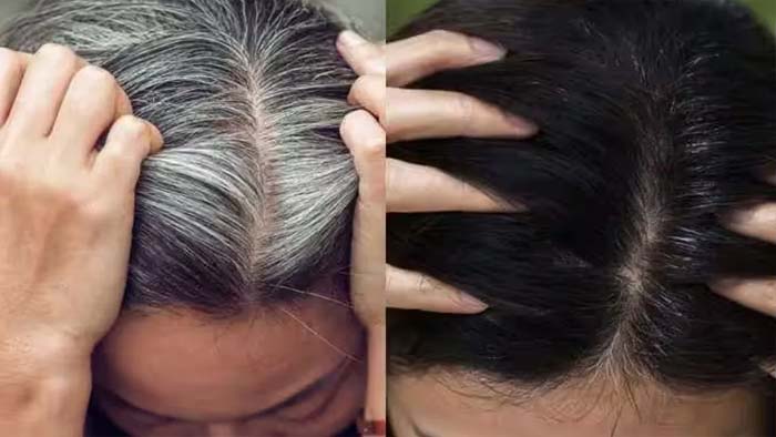 White Hair Home Remedies: తెల్లజుట్టు నల్లగా మారాలంటే.. వారానికి ఒకసారి ఇలా చేయండి..!