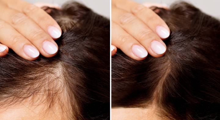 Hair Regrowth Oil : ఈ ఆకులను నూనెలో వేసి రాసుకుంటే జుట్టు ఒత్తుగా పెరుగుతుంది