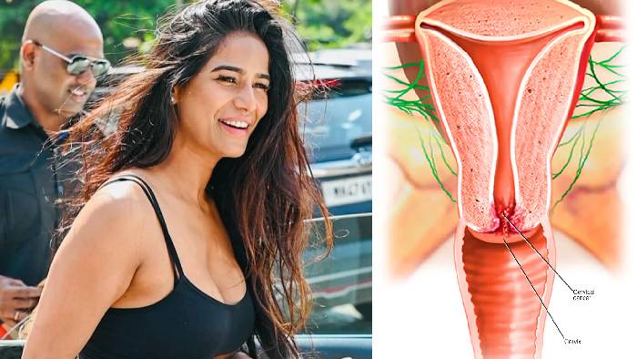Cervical cancer: గర్భాశయ క్యాన్సర్‌తో 32 ఏళ్లలో నటి-మోడల్ పూనమ్ పాండే మృ‌తి.. అసలేంటీ ఈ క్యాన్సర్..? మహిళల్లో ప్రమాదమెంత..?