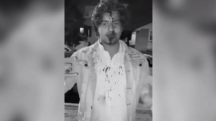 USA: అమెరికాలో హైదరాబాద్ విద్యార్థిపై దాడి..చికాగోలో ఘటన..