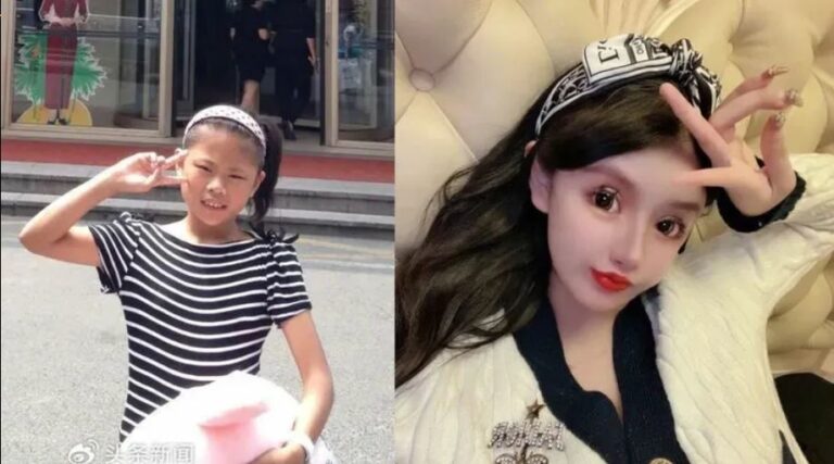 100 plastic surgeries: అలా కనిపించాలని 5 కోట్ల ఖర్చు చేసి 100 ప్లాస్టిక్ సర్జరీలు చేయించుకున్న అమ్మాయి..!