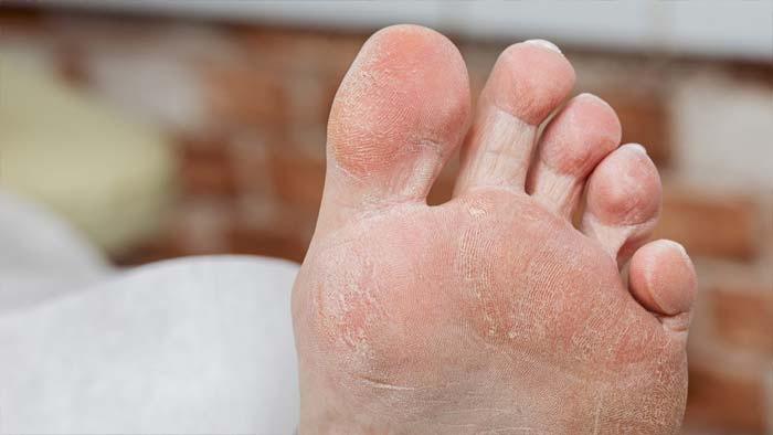 Dry Feet