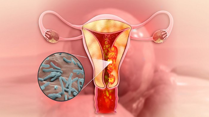 World TB Day: టీబీ మహిళల్లో వంధ్యత్వానికి కారణమవుతుందా?.. నిపుణులు ఏమంటున్నారంటే?