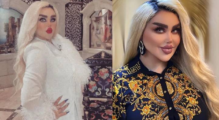 Viral News : అందంగా కనిపించాలని 43సర్జరీలు చేయించుకుంది..చివరికి జాంబీగా మారింది