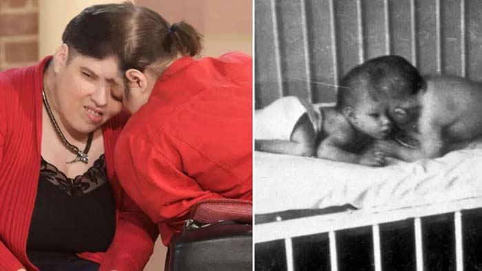 Lore and George: వరల్డ్ ఓల్డెస్ట్ అవిభక్త కవలలు ఇకలేరు..