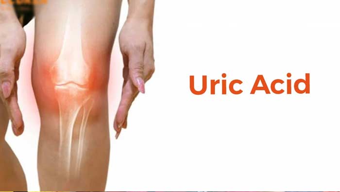 Uric Acid